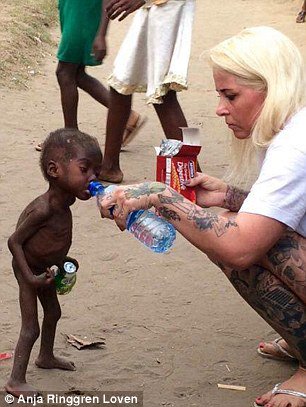 Amazing Recovery Of The Starving Child Labelled Witch